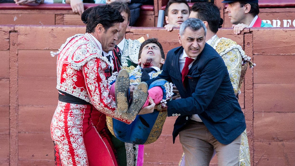 García Navarrete, se valora una posible intervención de clavícula