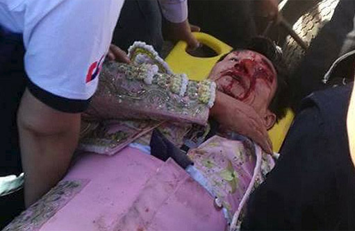 Rolly Pezo pierde un ojo en Perú y necesita la ayuda del sector