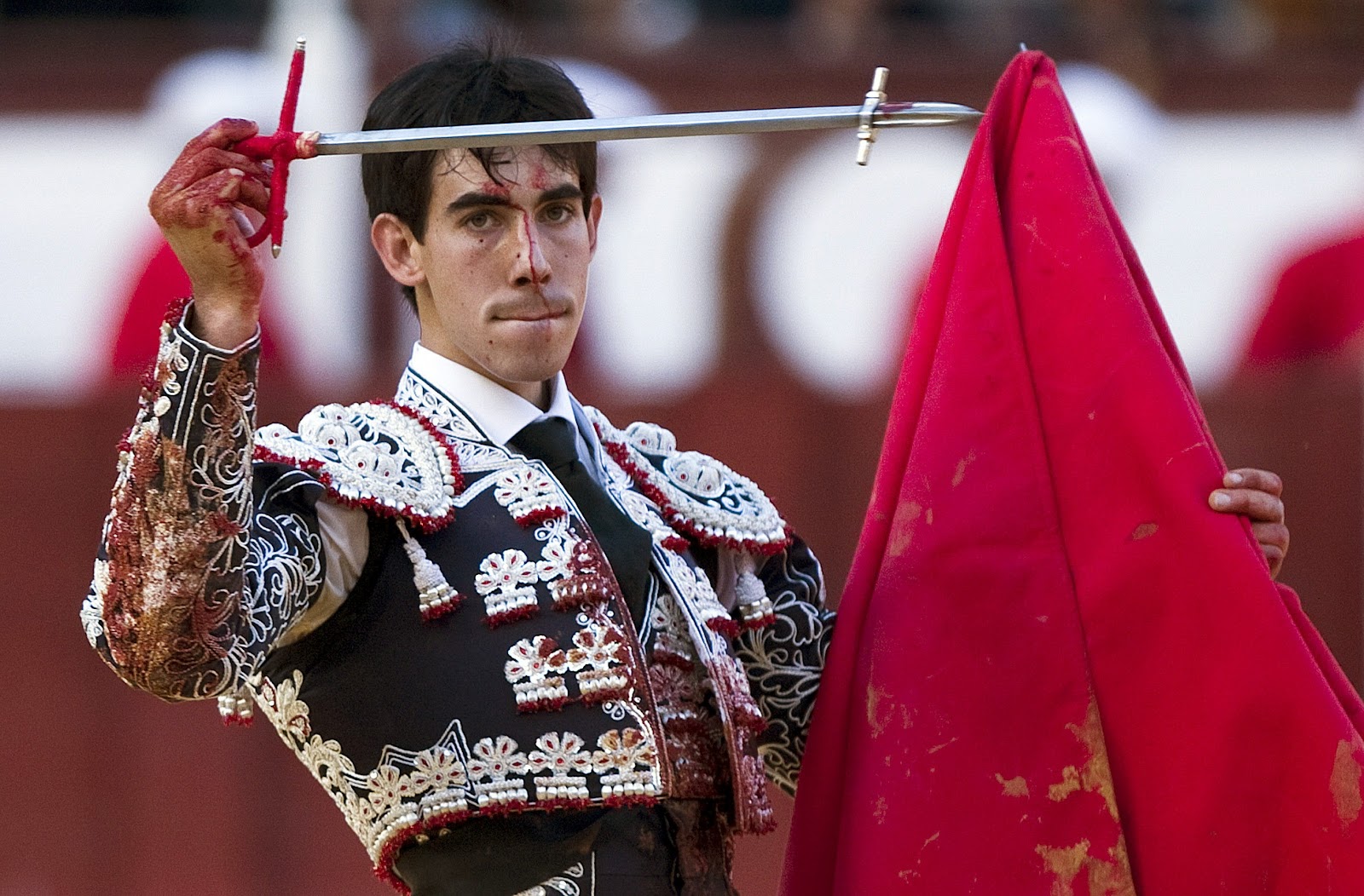 Descartada un rotura ósea a Fortes