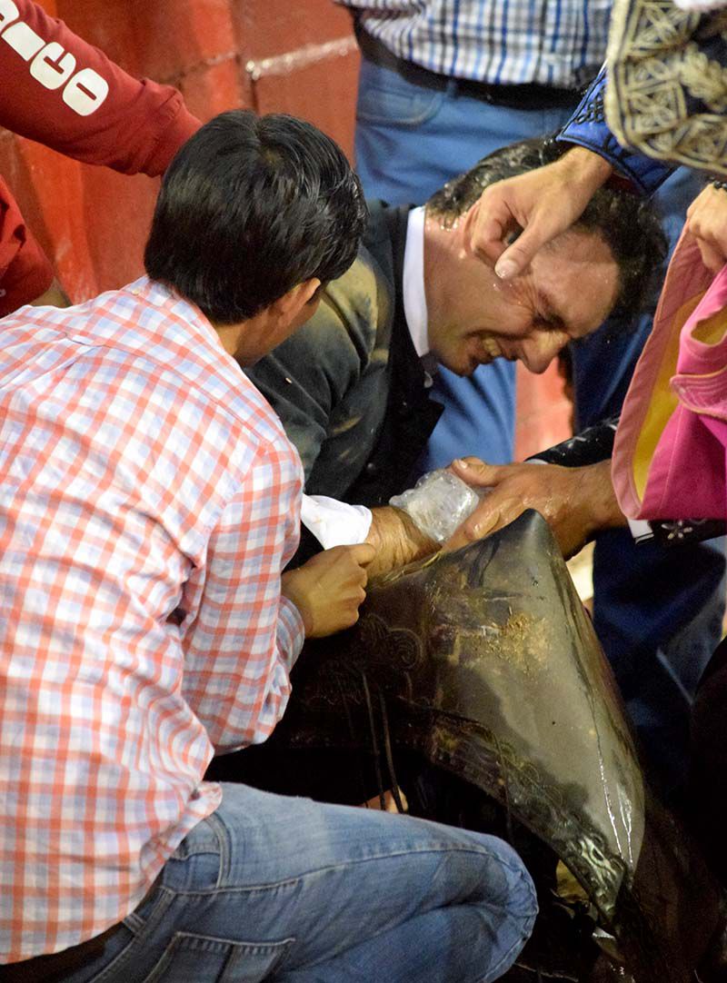 Andy Cartagena se fractura el radio en Autlán